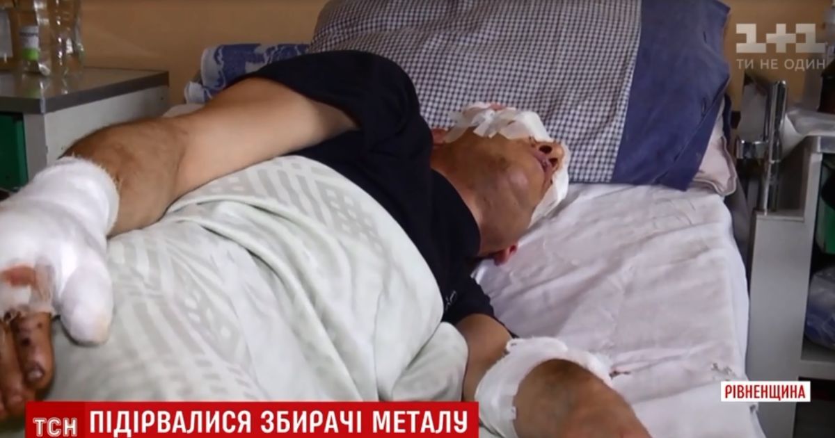 В частном дворе на Ровенщине взорвался артиллерийский взрыватель