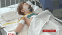У Дніпропетровську медики рятують трирічну дитину, що випала з четвертого поверху