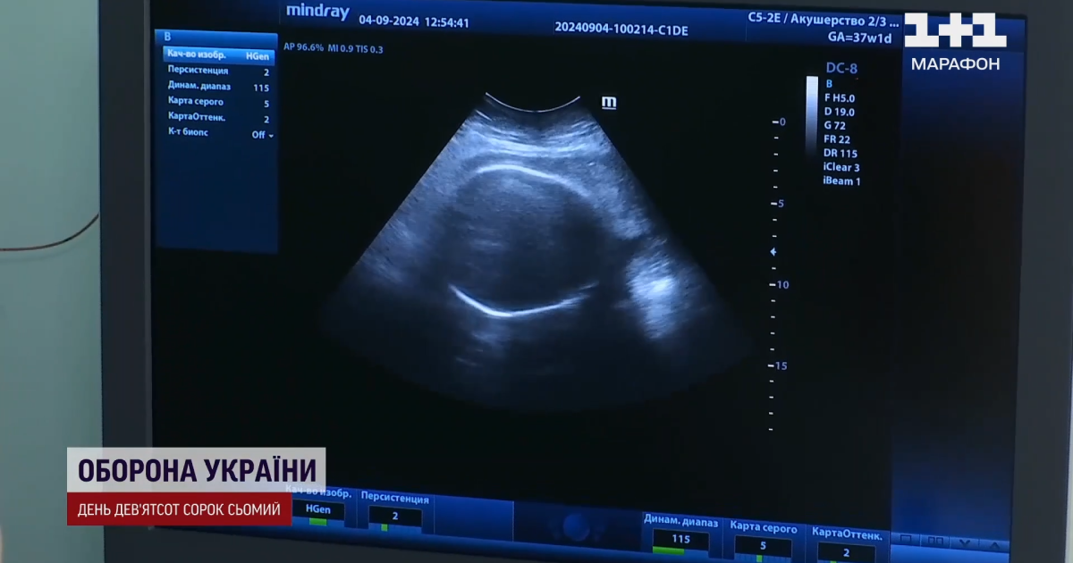 В Украине разразился скандал из-за суррогатного материнства