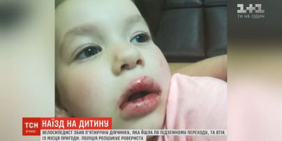 Многочисленные ушибы и выбитые зубы: в Киеве велосипедист сбил девочку и скрылся