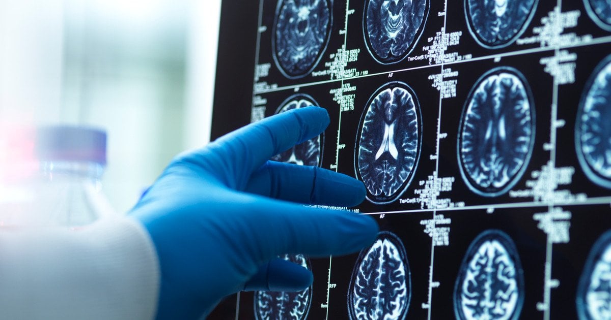 Дослідження мозку