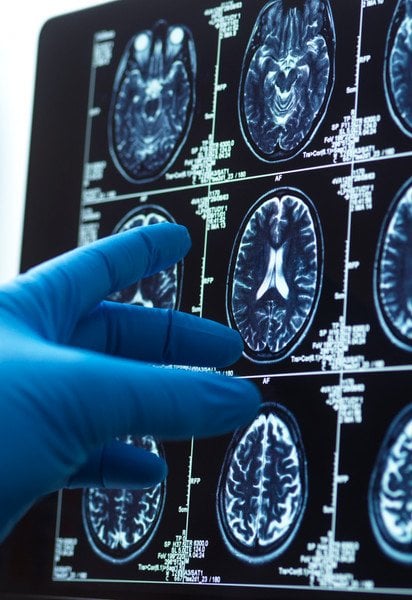 Исследование мозга