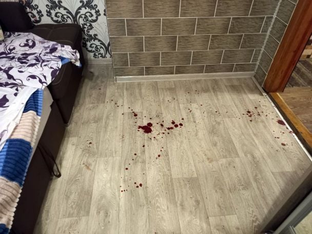 На Рівненщині чоловік вбив 20-річну дружину / © Національна поліція Рівненської області