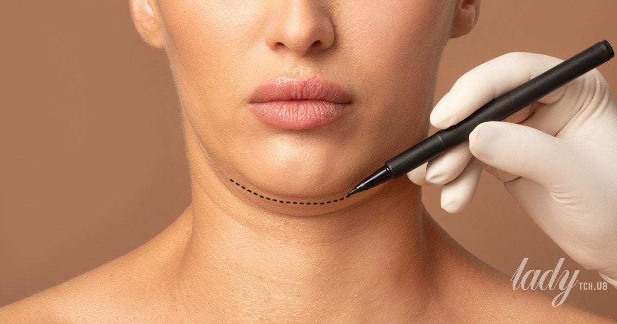 Як омолодити шию: розповідає пластичний хірург