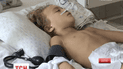 Львівські медики борються за життя маленького Матвійка, що заразився правцем