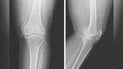 Золото у тілі жінки / Фото: The New England Journal of Medicine