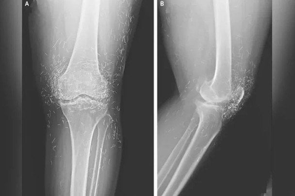 Золото у тілі жінки / Фото: The New England Journal of Medicine