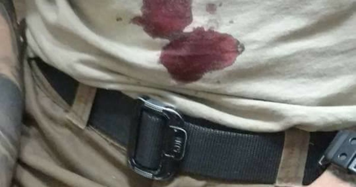 в одесі побили активіста_3 / © Facebook/ВО "Свобода" I Одеса