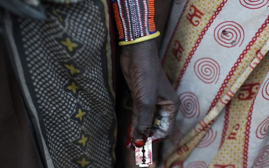 FGM Женское обрезание
