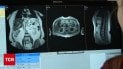 День борьбы против рака: как уберечься от страшной болезни?
