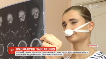 Невідомі побили 16-річного хлопця за зауваження не смітити у під'їзді