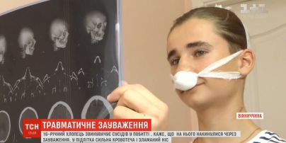 Невідомі побили 16-річного хлопця за зауваження не смітити у під'їзді