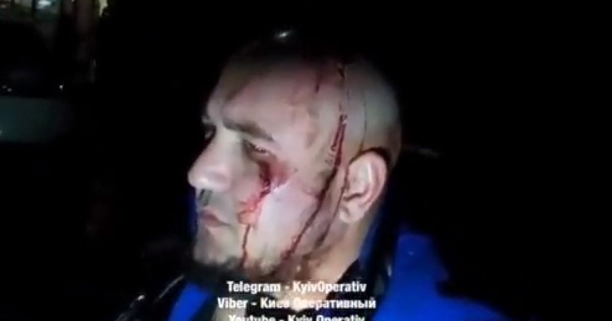 У Києві біля піцерії сталася масова бійка з перестрілкою