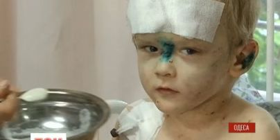 В Одесі розшукують батьків нещадно побитого 3-річного малюка