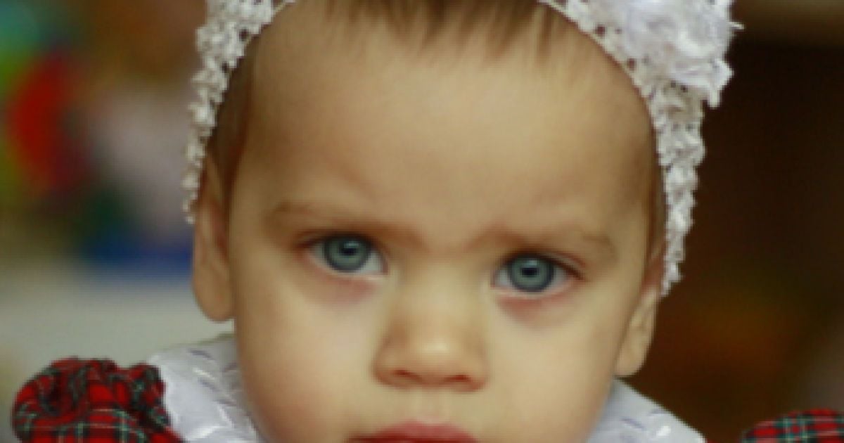 2-летняя Катюша нуждается в помощи