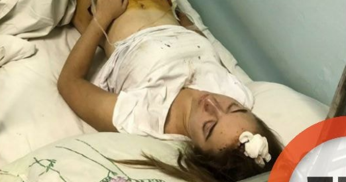 ДТП в Броварах: стало известно о состоянии пострадавшей девушки, потерявшей мать