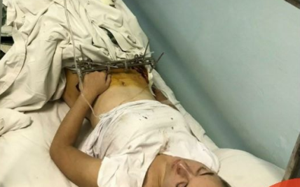 ДТП у Броварах: стало відомо про стан постраждалої дівчини, яка втратила матір