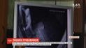 В Житомирской области полиция разыскивает грабителей, которые врываются в жилища одиноких женщин