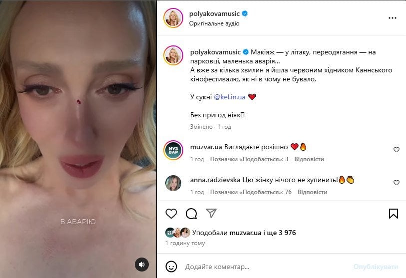 Оля Полякова попала в аварию и показалась на Каннском кинофестивале - фото  — Гламур