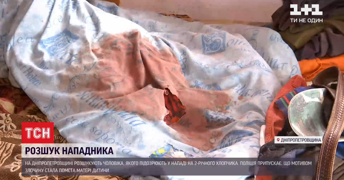 У Дніпрі рятують 2-річного малюка, якого порізав чоловік, щоб повернути колишню дівчину