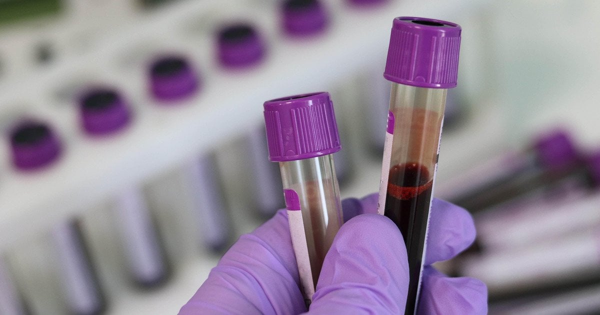 Лабораторний аналіз крові