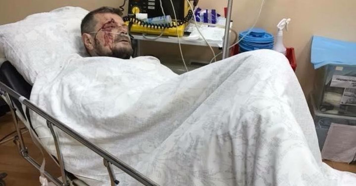 "Було дуже багато осколків". Медики розповіли про стан Мосійчука 