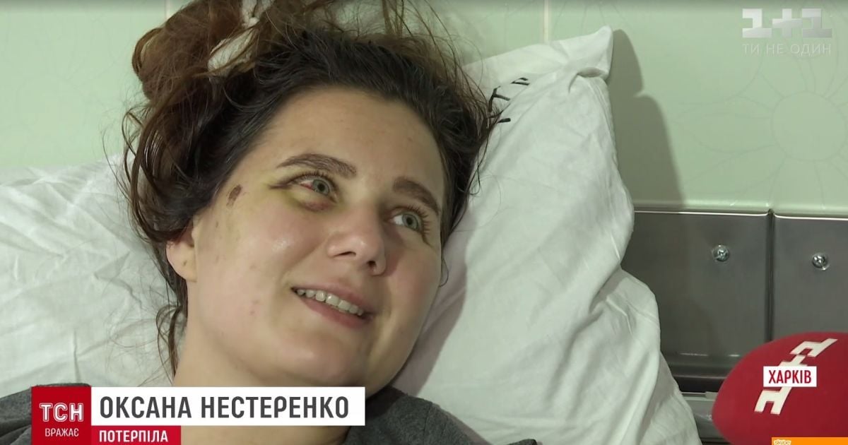 Авария в Харькове: пострадавшей девушке сделали сложную операцию