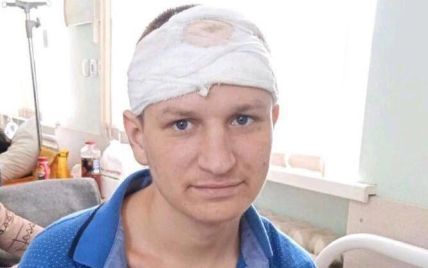 Війна в Україні: у лікарні Кривого Рогу виловили пораненого окупанта, який  імітував амнезію і видавав себе за цивільного — Укрaїнa — tsn.ua