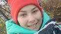 Даша через обмороження залишилась без пальців і з численними ранами – їй потрібна допомога