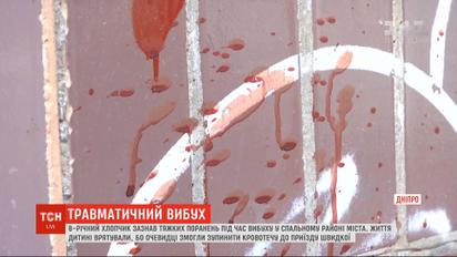 8-річному хлопчику відірвало кисть руки під час вибуху у Дніпрі
