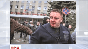 Міліцію Харківщини очолив офіцер-патріот, який дивом вижив після побиття сепаратистами