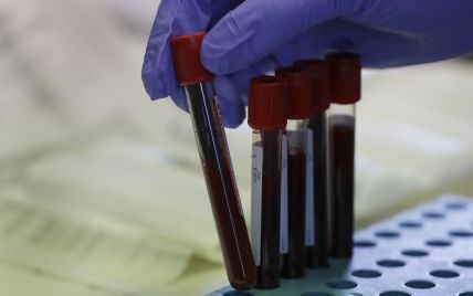 Лікування коронавірусу плазмою крові: як працює метод та чи дозволено це в Україні