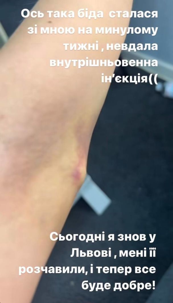 Оля Полякова / © instagram.com/polyakovamusic