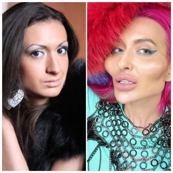 Анастасия ПОКРЕЩУК к пластике / © instagram.com/_just__queen_