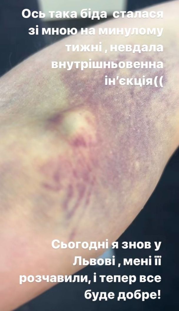 Оля Полякова / © instagram.com/polyakovamusic