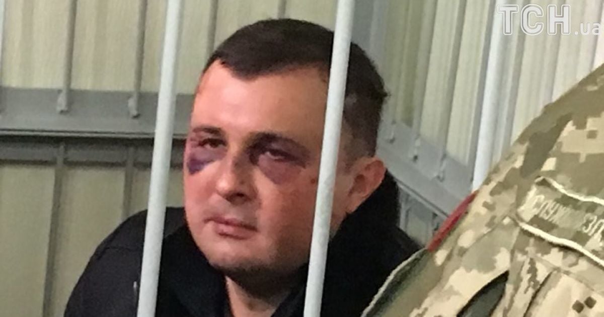 Шепелєва у синцях привели на засідання щодо обрання запобіжного заходу