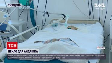 Новости недели: покалеченный ребенок - кто поиздевался над 7-летним мальчиком из Черкасс