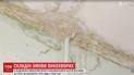 Вода і штукатурка на голову, грибок на стінах: онкохворих українців лікують у жалюгідних умовах