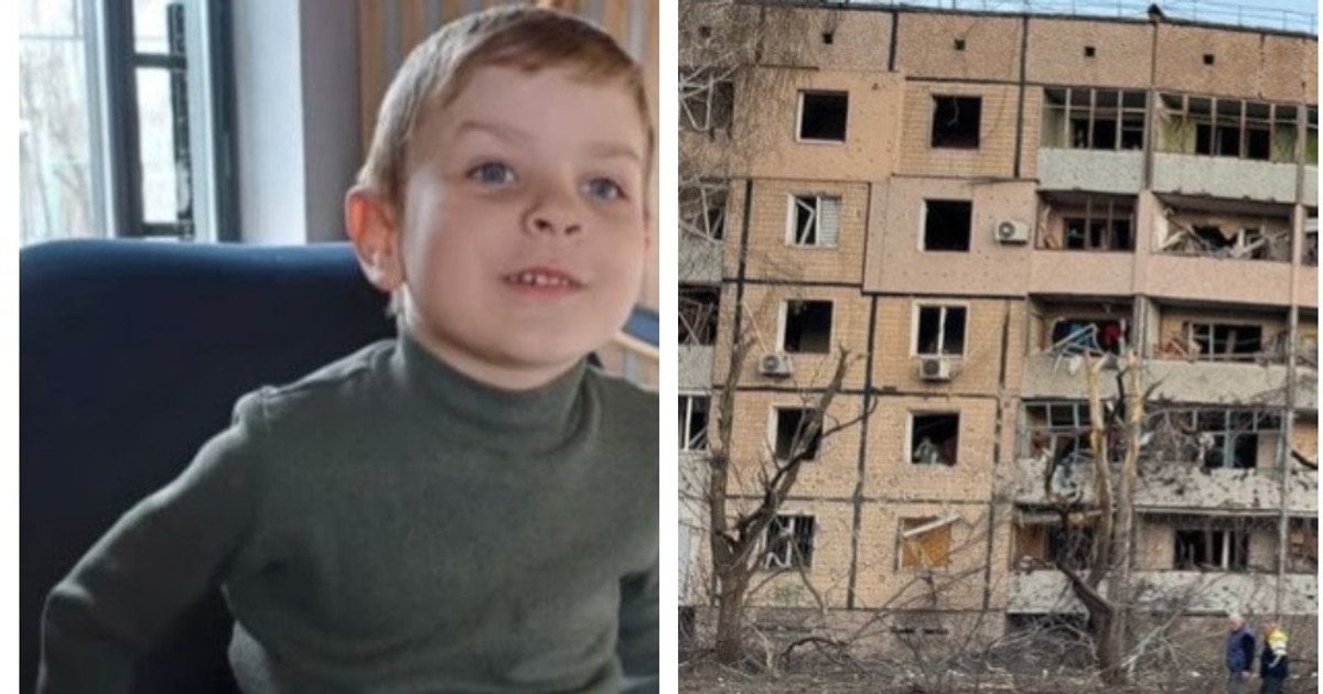 4-летний Ярчик борется за жизнь после ракетного удара