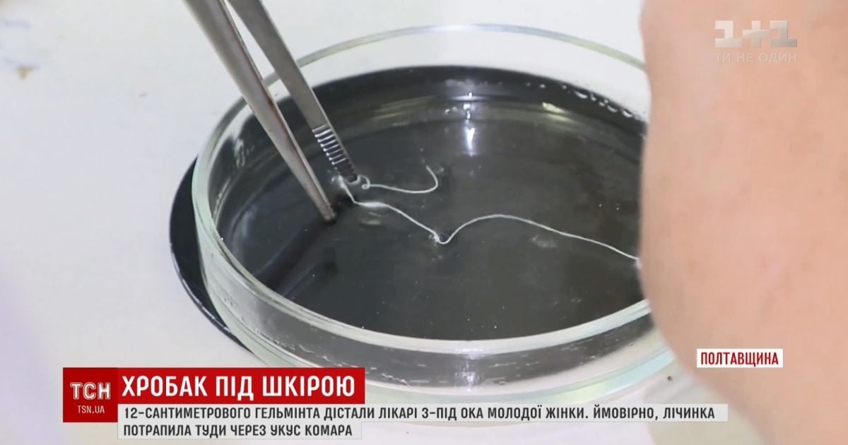 Хробак в оці: українцям розповіли, як уникнути огидної хвороби під назвою дирофіляріоз