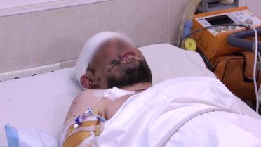 Всі в машині кричать! Я стікаю кров'ю! - Медики врятували життя і мозок військового Тараса!