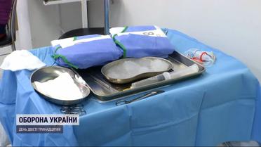 Диво-операція: київські хірурги видалили пухлину поза тілом пацієнтки