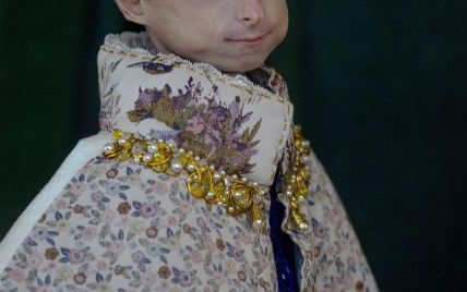 Їй було 10 років і вона померла від старості: зворушлива історія Іринки Химич, якій вдалося намалювати щастя