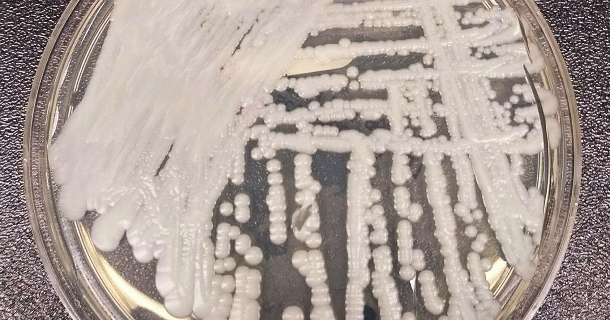 Штам Candida auris. Фото: Бібліотека зображень у сфері громадського здоров’я (PHIL) Центрів з контролю та профілактики захворювань (CDC) під ідентифікаційним номером #21796