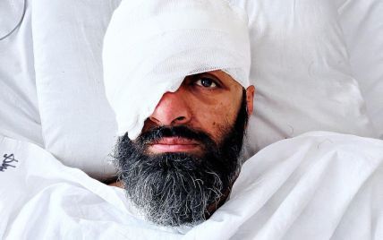 Адвокат Маси Найем опубликовал свое первое фото после тяжелого ранения и потери глаза на фронте