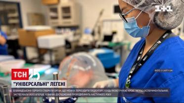 Канадські науковці створили "універсальні" донорські легені