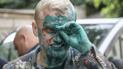 "Зеленкою не обійдеться – ти просто зникнеш": Шабунін розповів про погрози після нападу