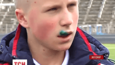 В Житомирской спортивной школе разъяренный мужчина избил 14-летнего парня