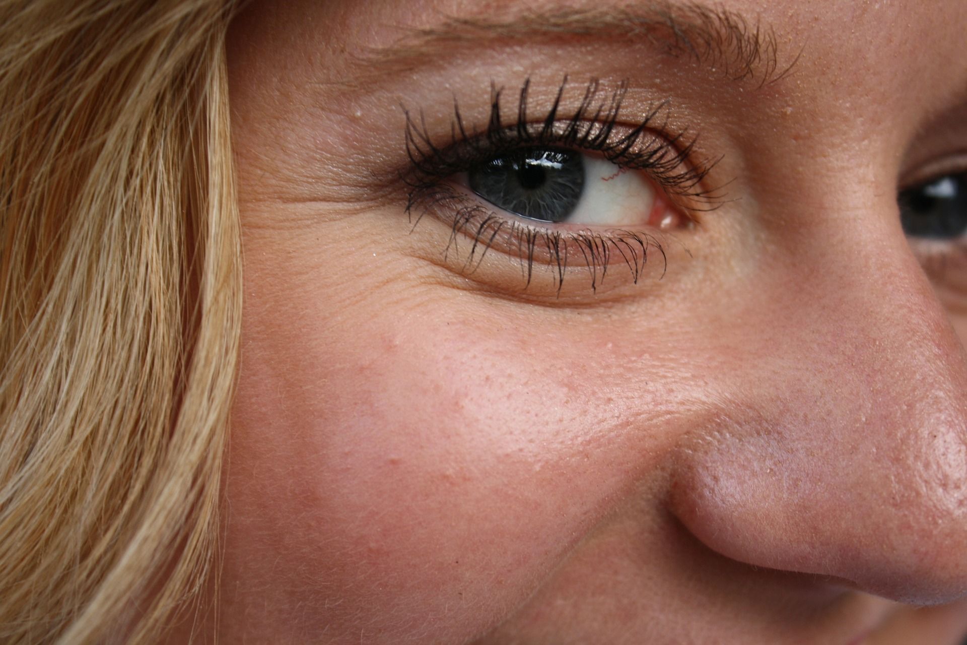 3 простых способа убрать «гусиные лапки» вокруг глаз — справишься без уколов!