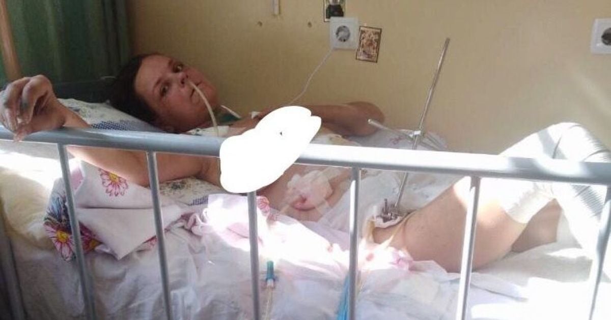 Оля дивом вижила в аварії і тепер потребує допомоги
